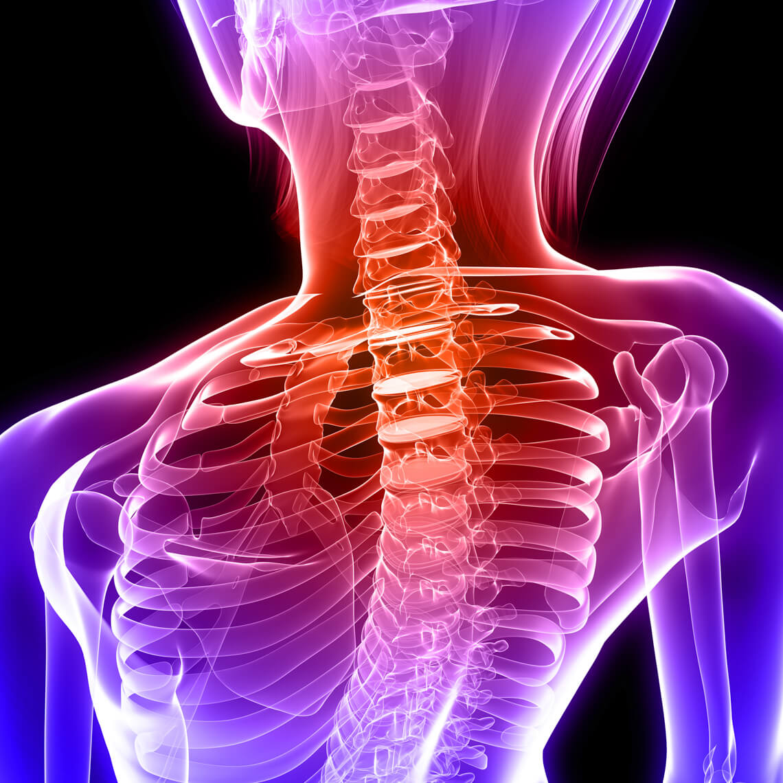 wrong level spine image