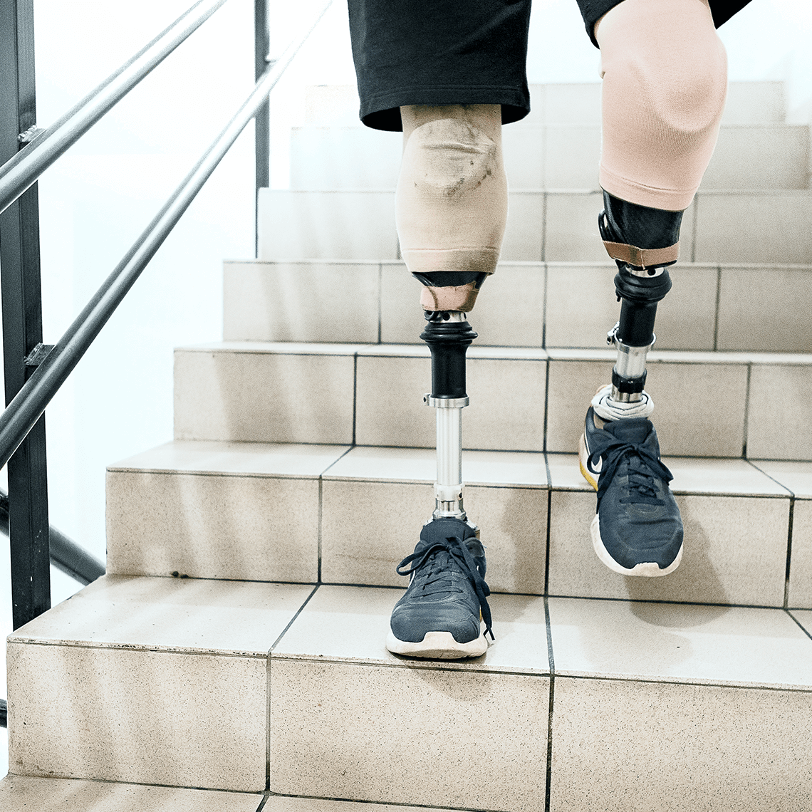 casestudy 2023 amputation 1x1